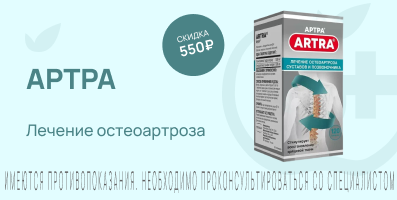 Акция на Артра 